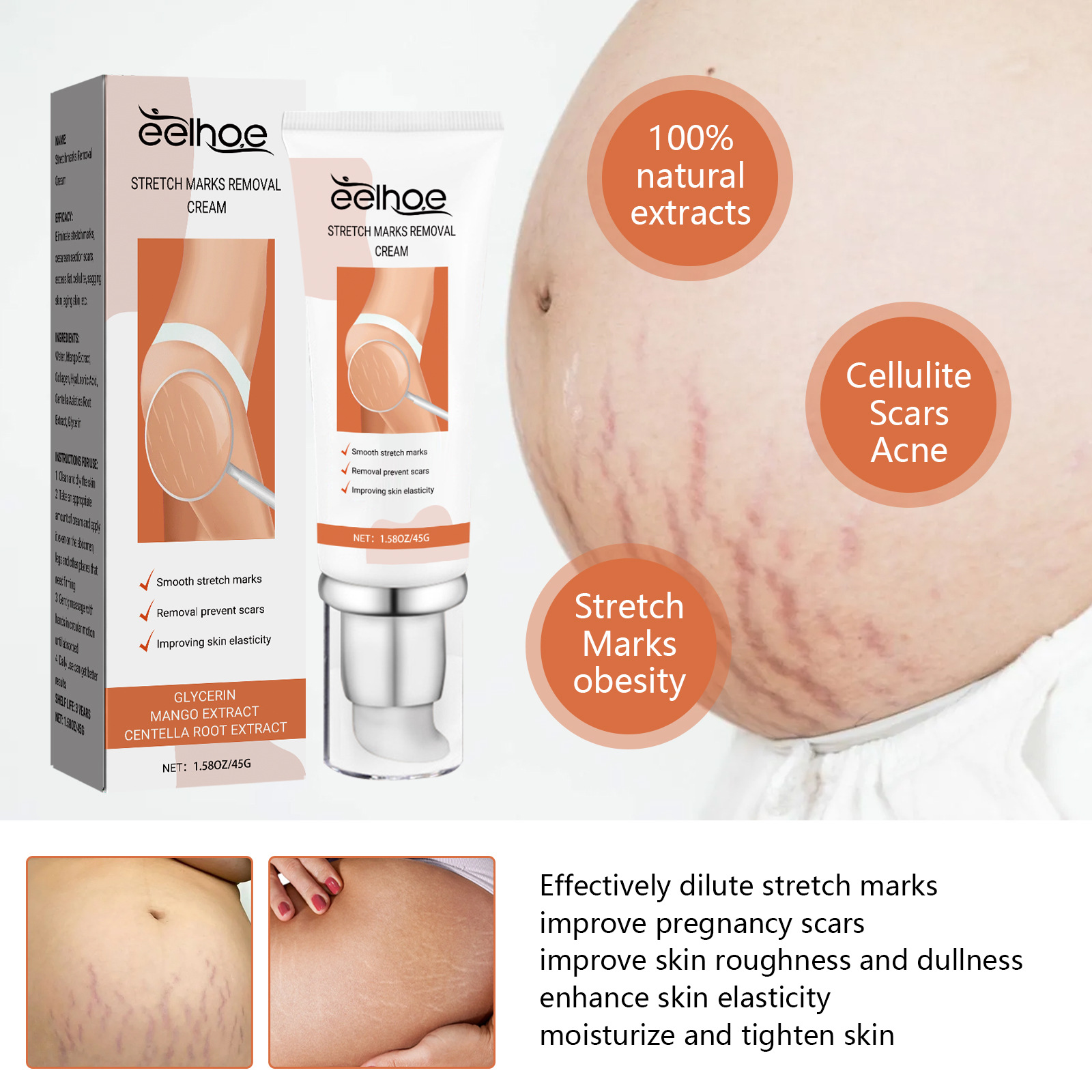 Eelhoe Pregnancy Scar Repair Cream