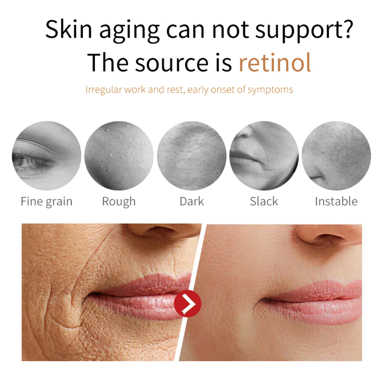 Eelhoe Retinol Anti-Aging Cream Fade Fine Lines around the Eyes and Tighten and Lift Facial Skin