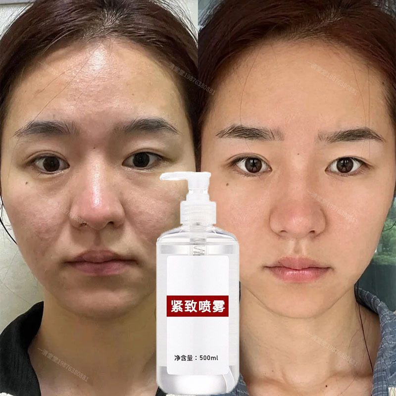 童颜去皱喷雾淡化细纹紧致法令纹面部松弛抗皱精华液青