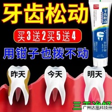 牙齿松动牙龈肿痛牙根暴露牙龈固齿护理防蛀牙牙膏去黄牙到家代发