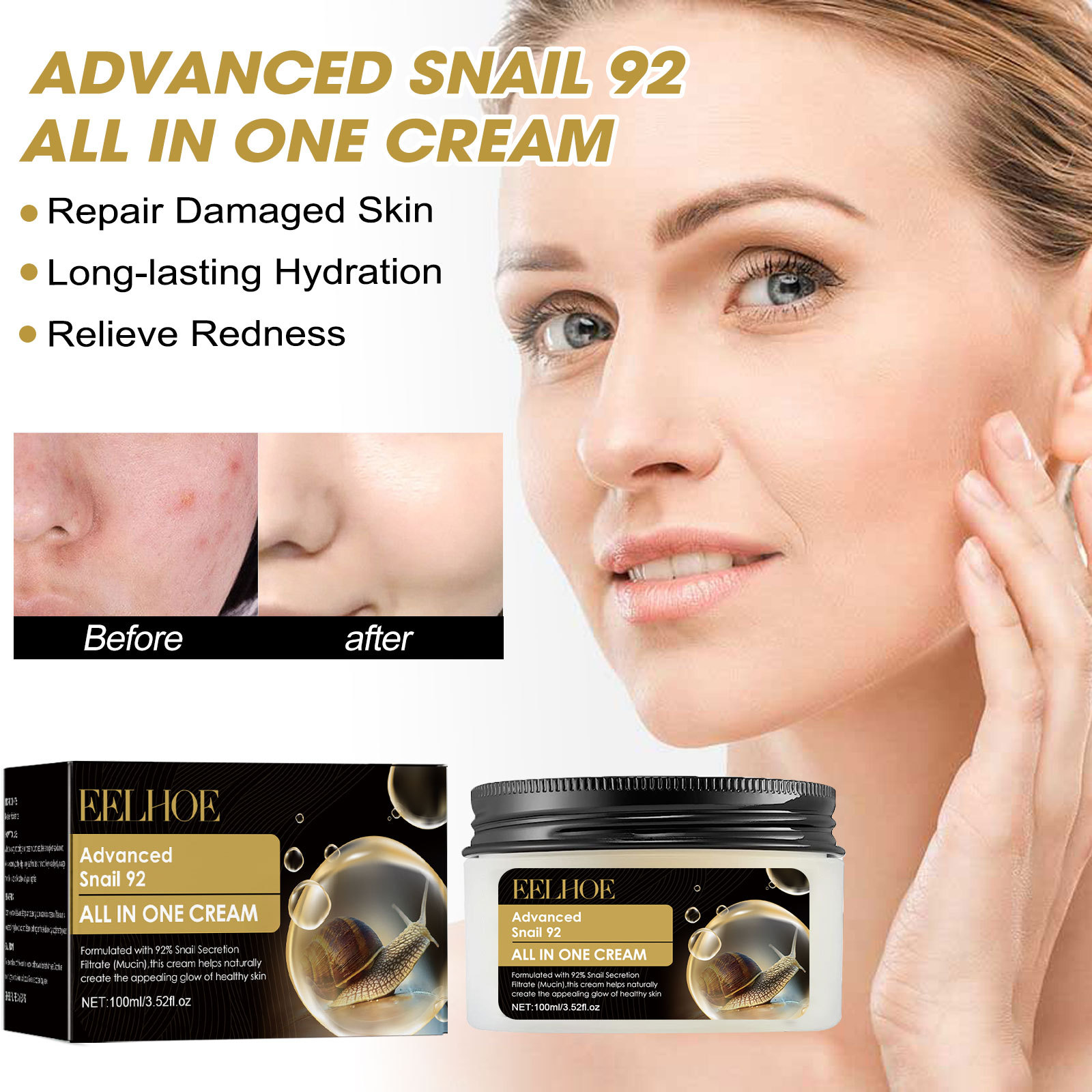 Eelhoe Snail 92 Recovery Cream Fade Acne Skin Acne Marks Hydrating Whitening Firming Skin Cream