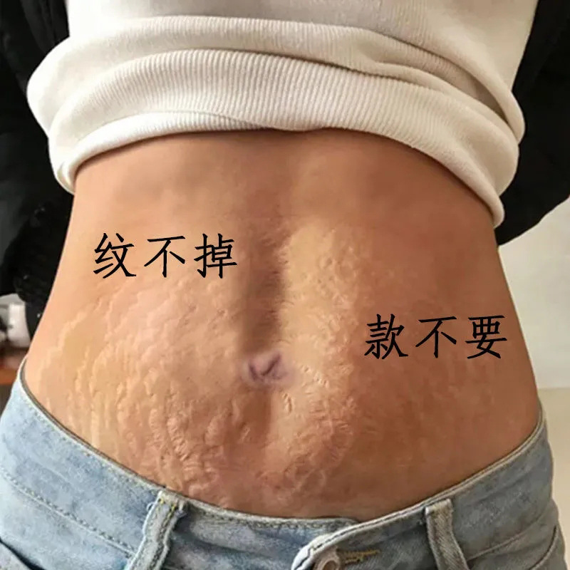 佰草世家去产后纹修复霜祛生长纹肥胖纹专用预防妊辰修复膏