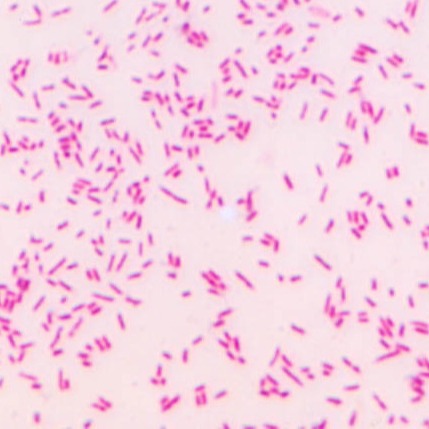 细菌类微生物玻片he染色均匀大肠杆菌涂片教学-阿里巴巴