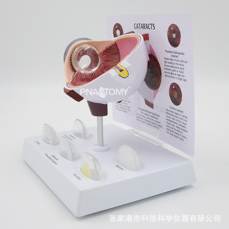 眼球模型病理眼球演示教具眼科展示礼品人体器官解剖模型放大教学