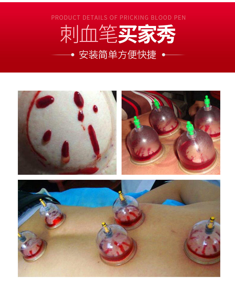 五头刺血笔三棱采血针笔非无痛放血笔拔罐多头泻血针家用刺络排瘀