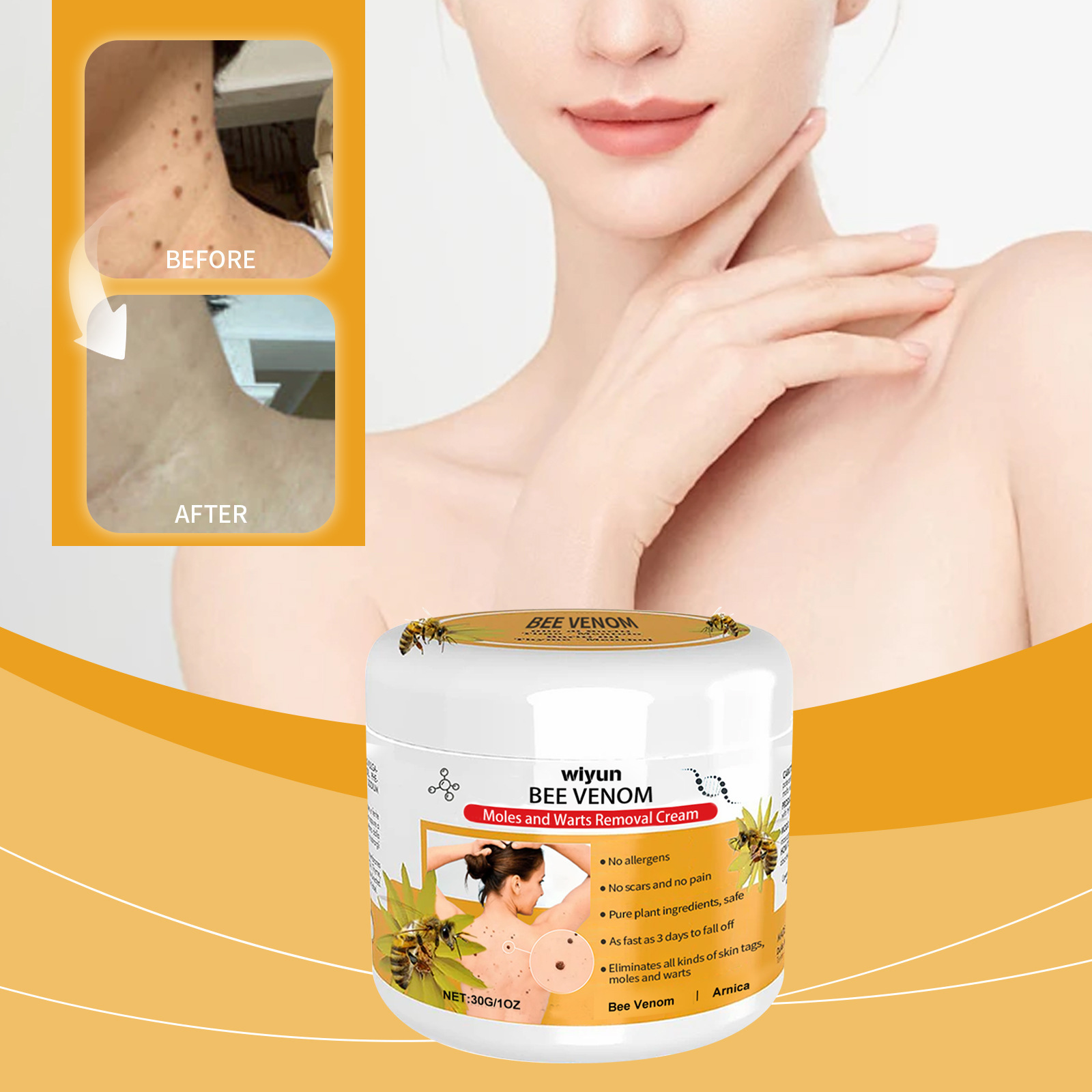 wiyun 蜂毒克疣护理霜 温和清洁皮肤标签肉粒克疣滋润平滑肌肤