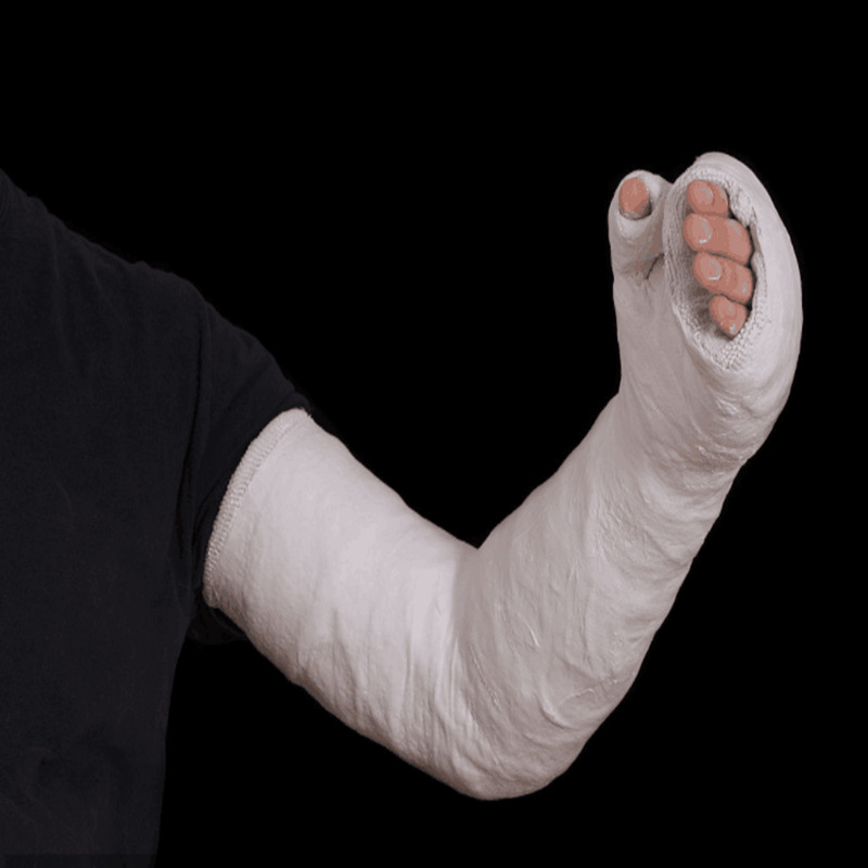 石膏绷带骨折矫形模型倒模沙盘塑型形胶布高分子绷带石膏纱布