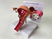 英文女性子宫模型内生殖器官结构解剖人体教 学病理卵巢医院学校