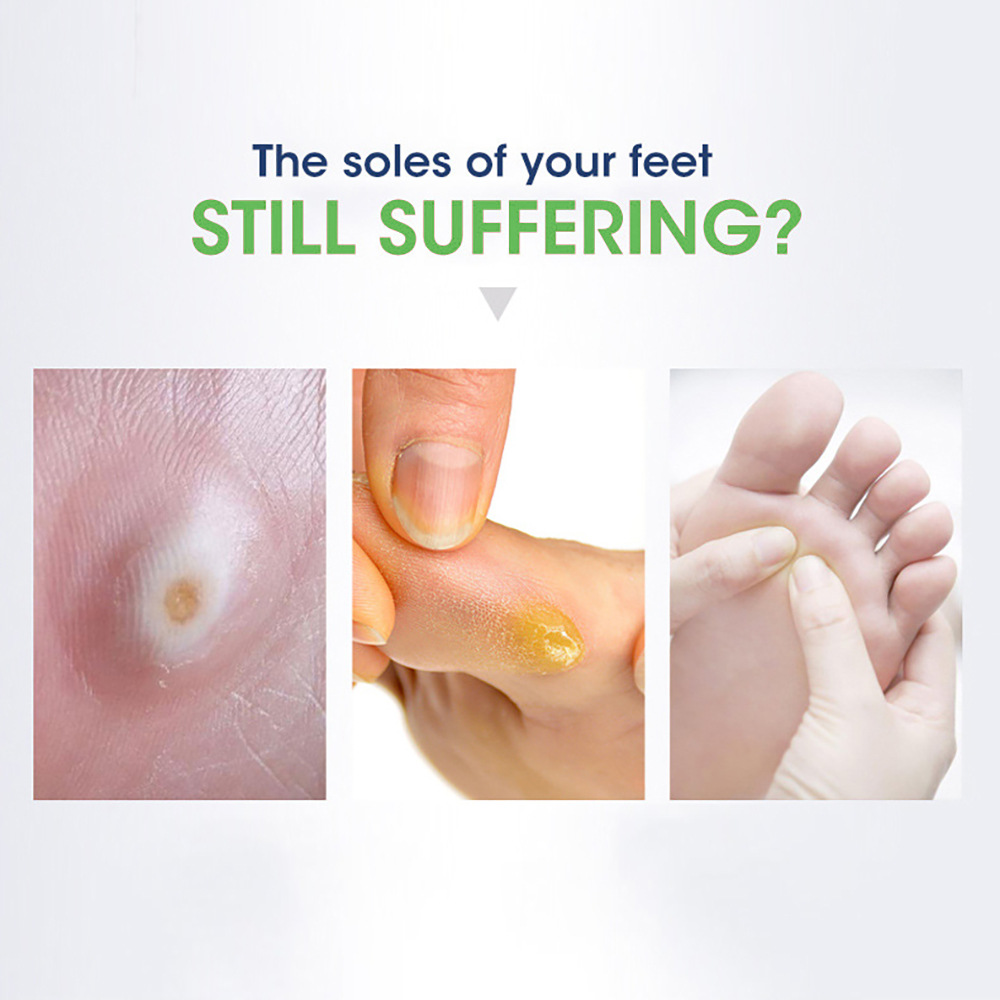 跨境速卖通亚马逊鸡眼贴足部护理去肉刺死皮脚底贴老茧鸡眼贴