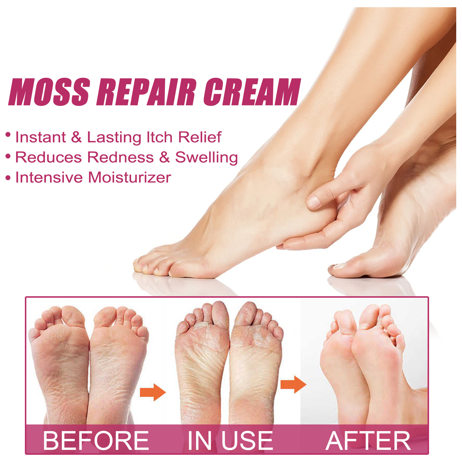 Eelhoe Skin Moss Hands and Feet Moisturizing Cream Repair Relieve Itching Relieve Itching Moisturizing Skin Hydrating Moisturizing