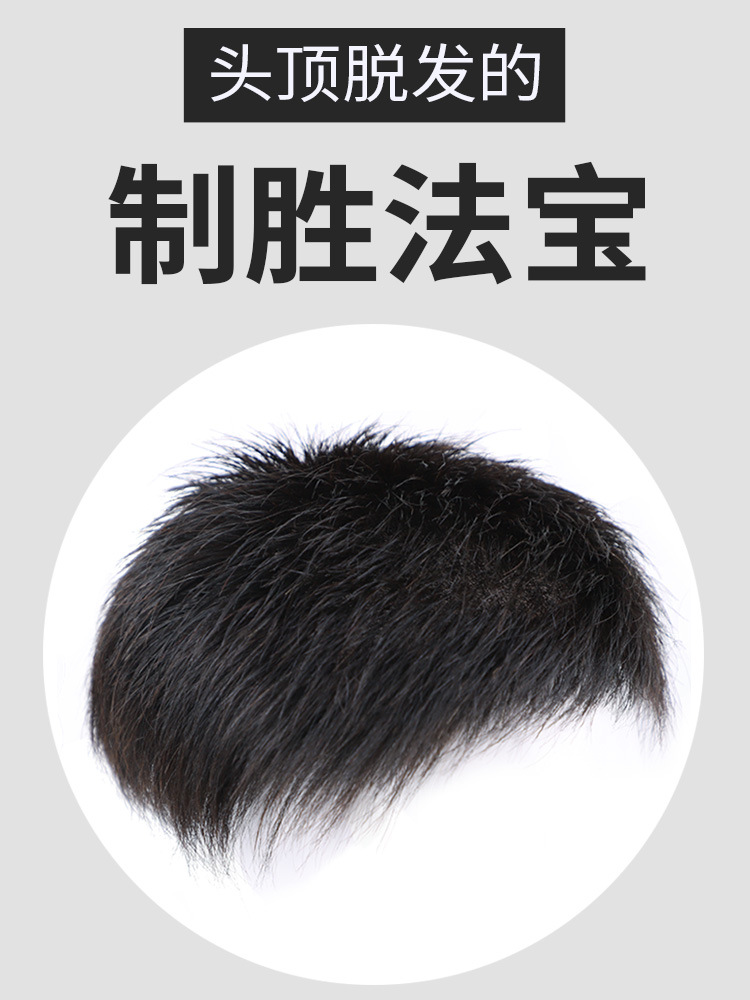 男士假发男短发帅气韩版头顶补发片男假发片秃顶前额男式真发补发