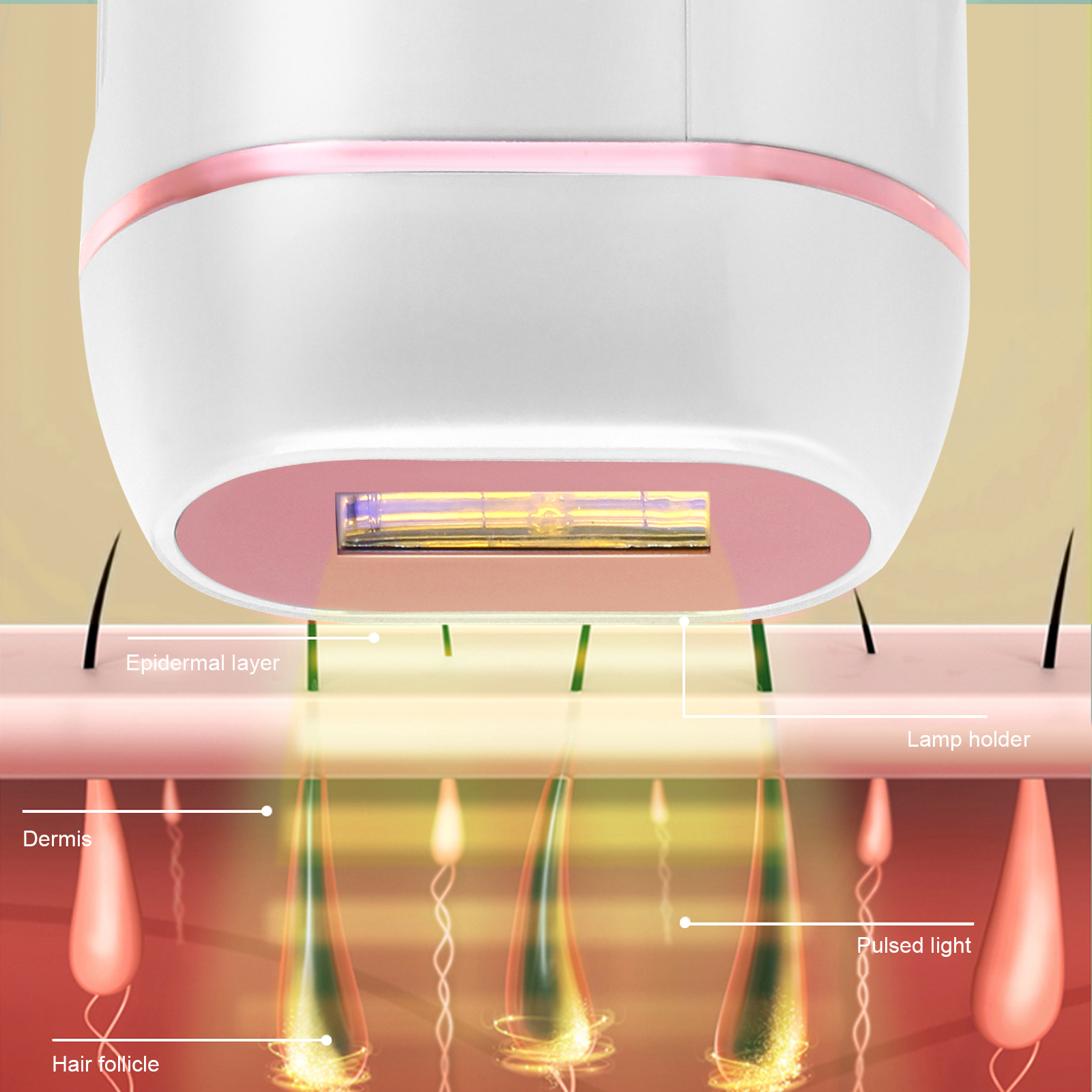 脱毛仪家用 冰点无痛全身脱毛器 手持ipl冰敷光子 激光脱毛仪器