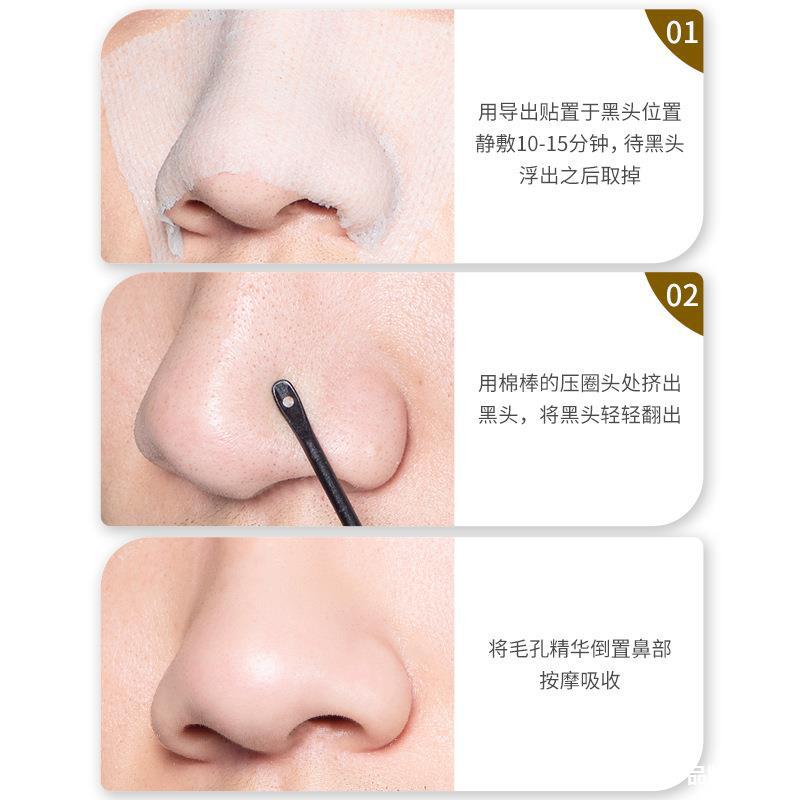粉刺针刮黑头工具铲无菌毛孔鼻头挤去黑头勺一次性闭口针刮棒神器