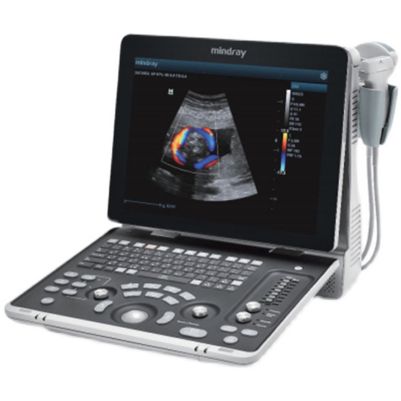 迈瑞便携彩超机彩色多普勒超声系统迈瑞b超机手提黑白超声诊断仪