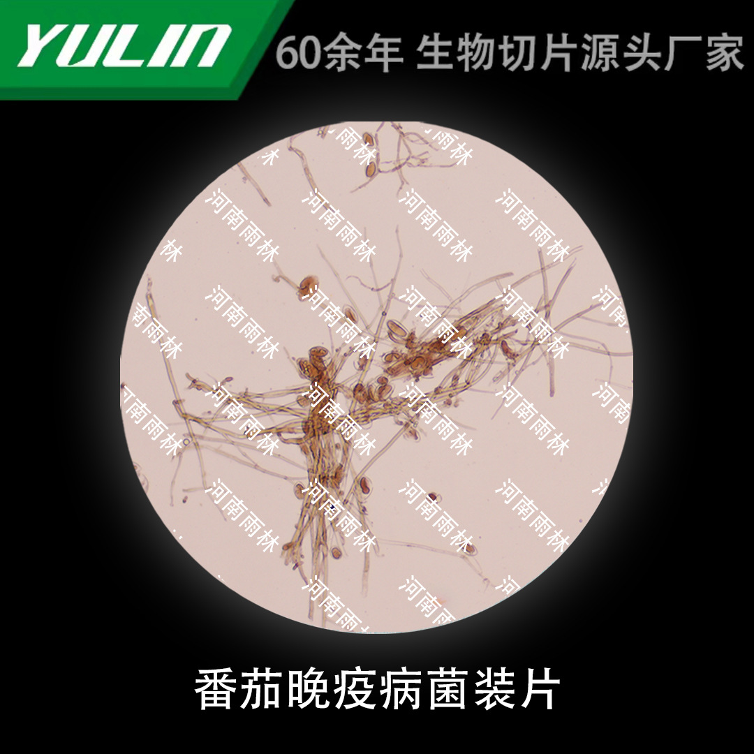 番茄晚疫病菌装片生物显微镜标本动物植物细胞载玻片观察实验高校