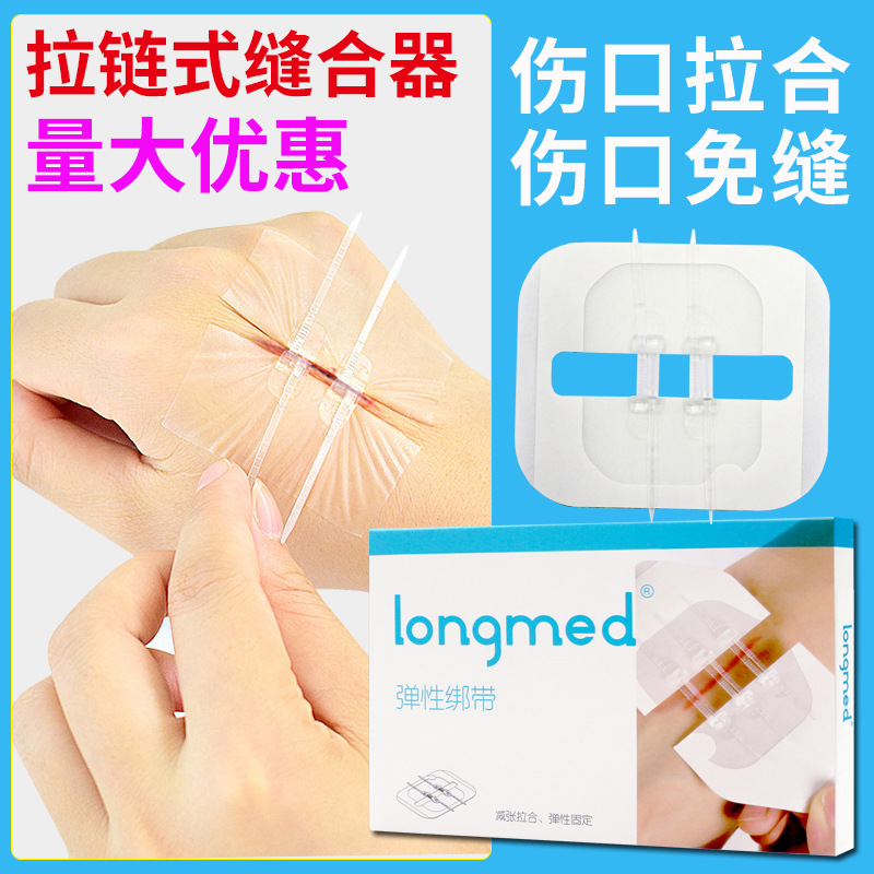 拉链式缝合器减张贴伤口家用免缝合贴皮肤减张器吻合器拉合贴固定