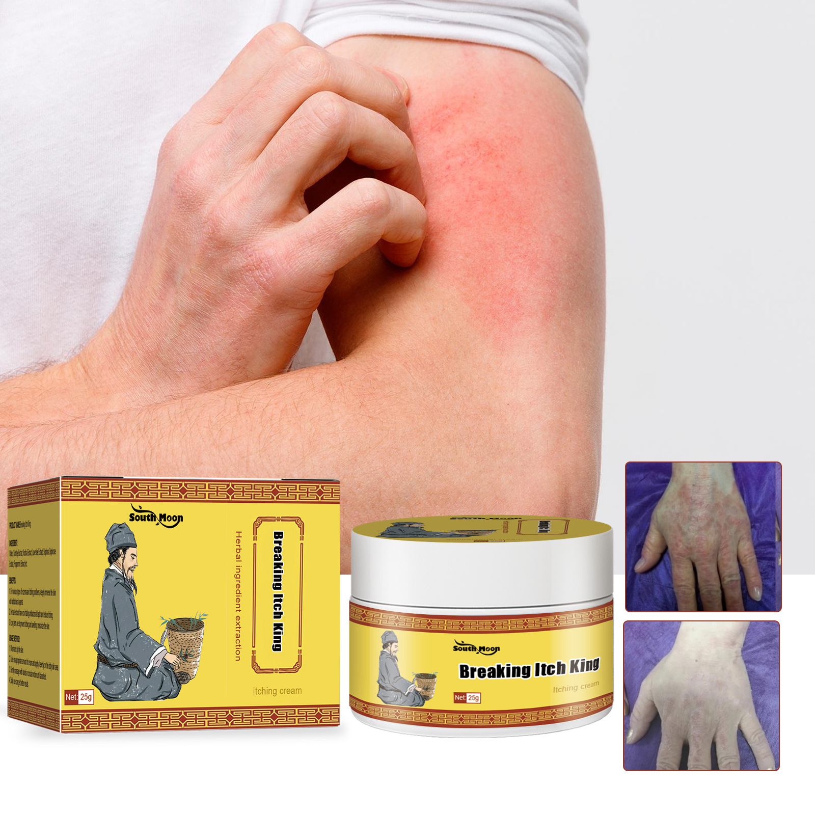South Moon Anti-Itch Ointment Relieve Hand and Foot Moss Skin Moss Redness Repair Skin Itching Skin Care Cream