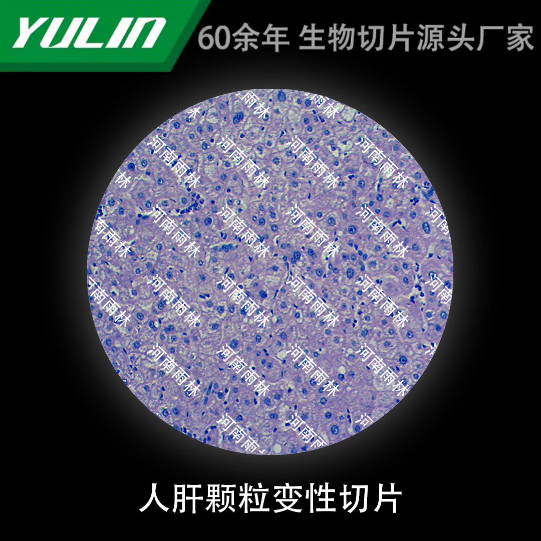 人肝颗粒变性切片生物显微镜标本动物植物细胞载玻片观察实验高校