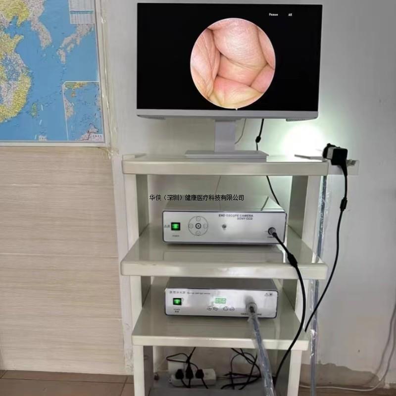 耳鼻喉医用内窥镜摄像系统鼻腔可视检查仪可视采耳设备-阿里巴巴