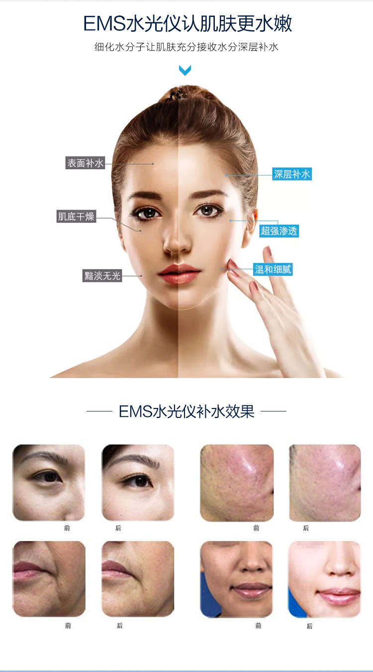 wish,速卖通,独立站,lazada适用场景商用颜色ems水光仪 一套 水光专用