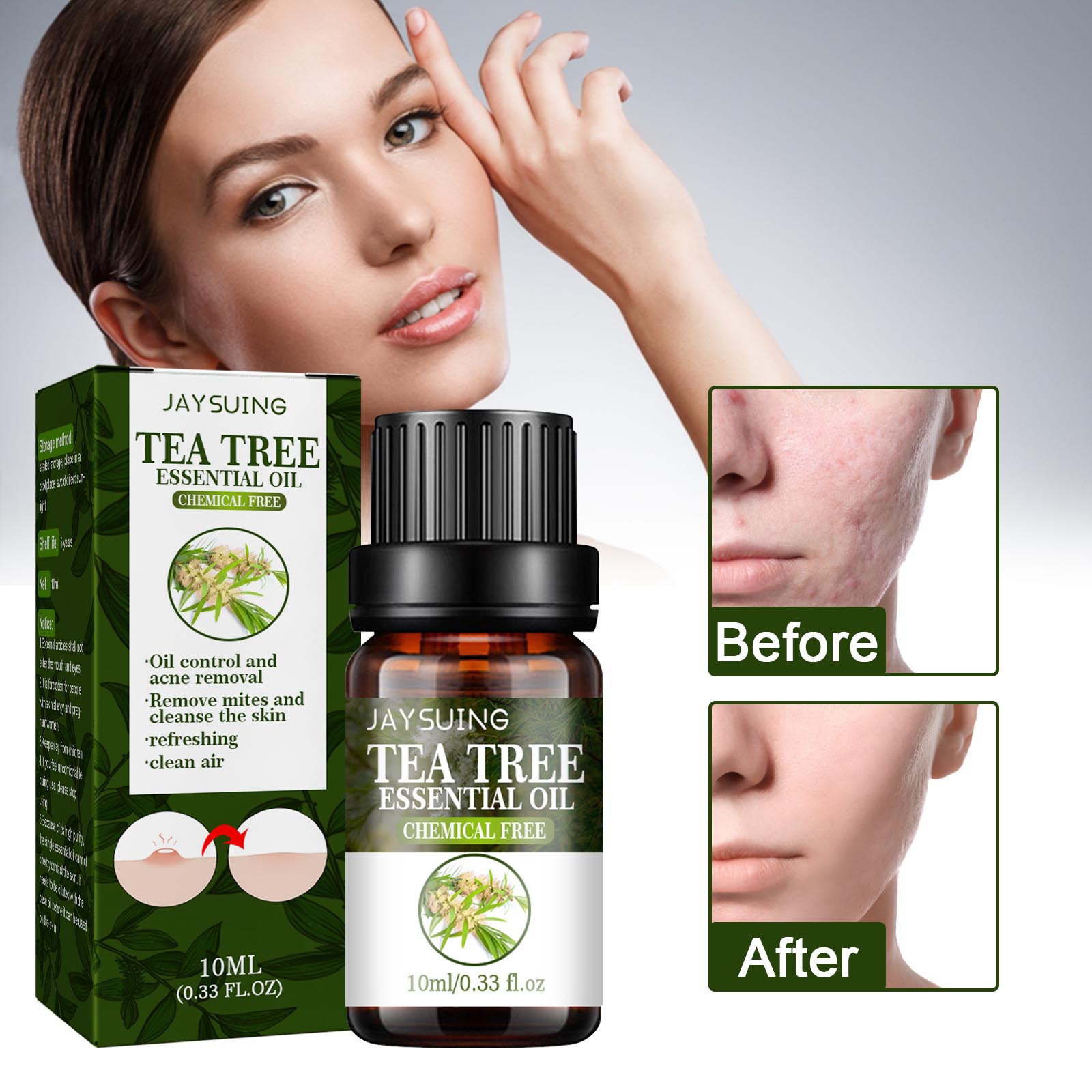 jaysuing 茶树祛痘精油 面部熬夜油痘净痘淡化痘印修护液滋润保湿
