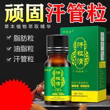 祥医堂汗粒清去脂肪粒专用膏药膏神器精华液抑菌液眼霜眼部汗管瘤