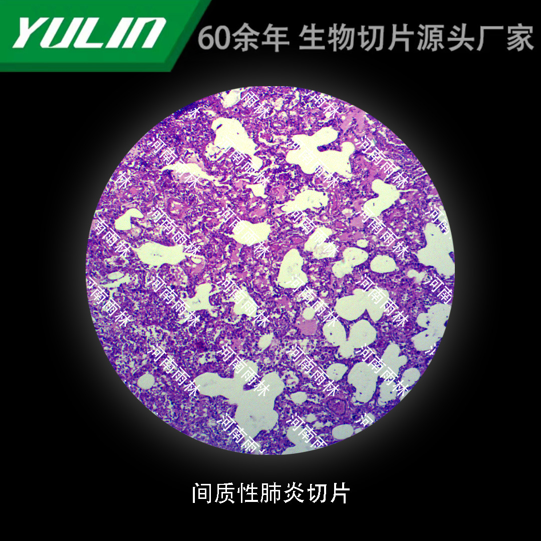 间质性肺yan切片高校医学院校用组织病理石蜡玻片标本显微镜-阿里巴巴