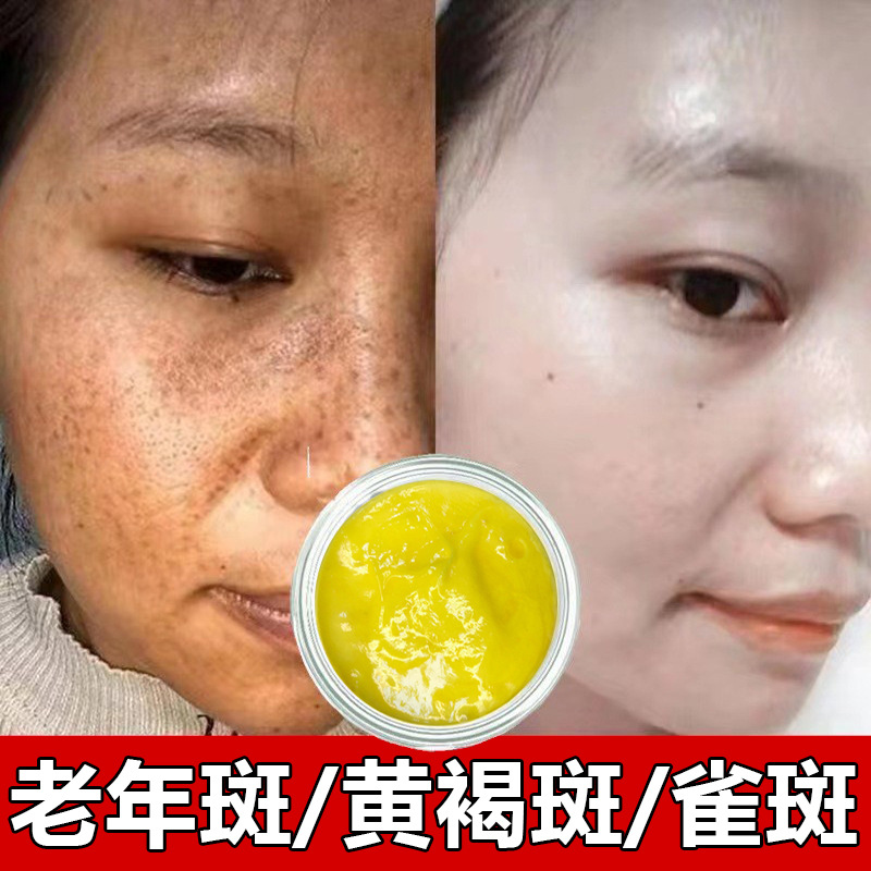 草本黄芪霜美白祛斑霜强效去黄褐斑雀斑美容院控色霜日霜晚霜批发