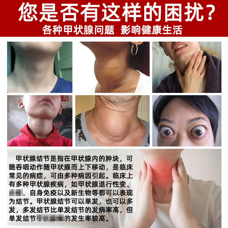 雅康宁甲状腺结节消散结贴甲状腺脖子肿大甲状腺结减甲亢甲状腺膏