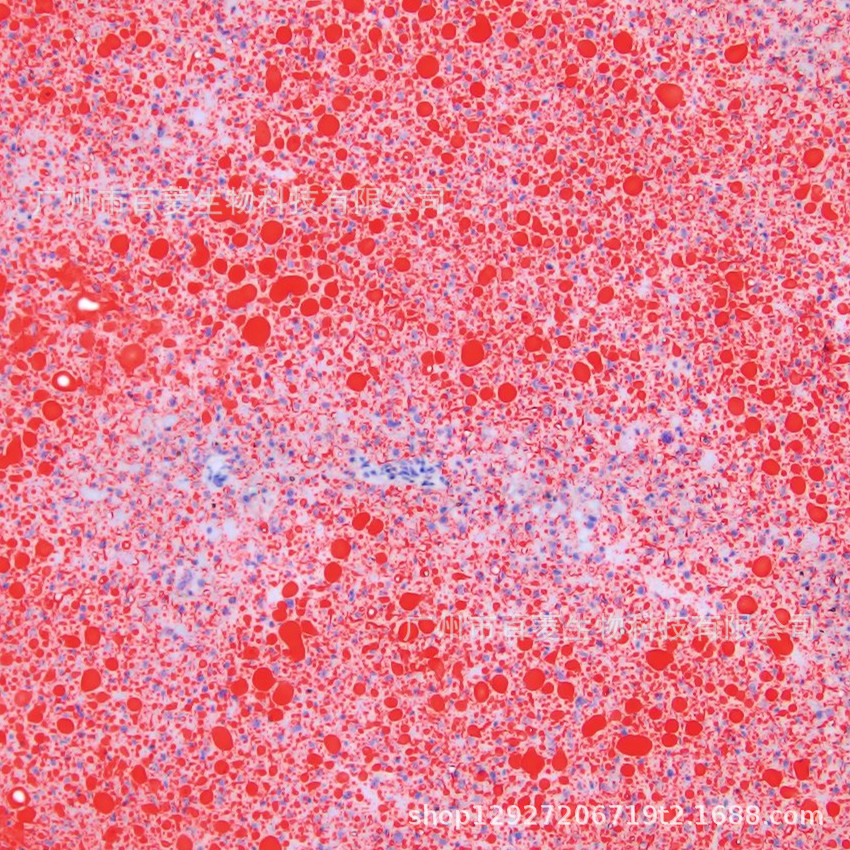 油红o染色液(细胞用)oil red o stain kit(for cultured cells)