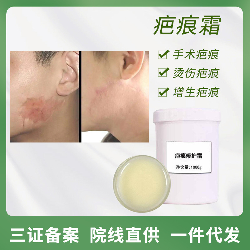 疤痕膏修复疤腹产增生疤术后疤痕痘印痘坑伤疤美容院娠纹修护霜
