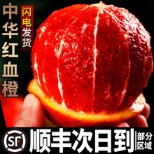 血橙新鲜水果10斤带箱秭归中华红橙子新鲜水果当季整箱顺丰其他