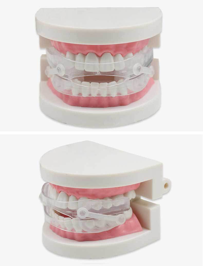 创生源止鼾器口腔矫治器防呼噜治疗打鼾阻鼾器止鼾牙套