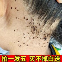 虱子药小女孩头发儿童孩子去除头虱子跳蚤一扫光百部酊灭头虱神器