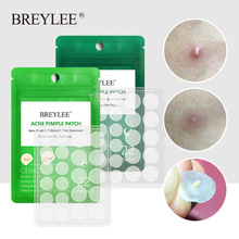 Acne Pimple Patch  Stickers Acne Treatment Pimple Remover To