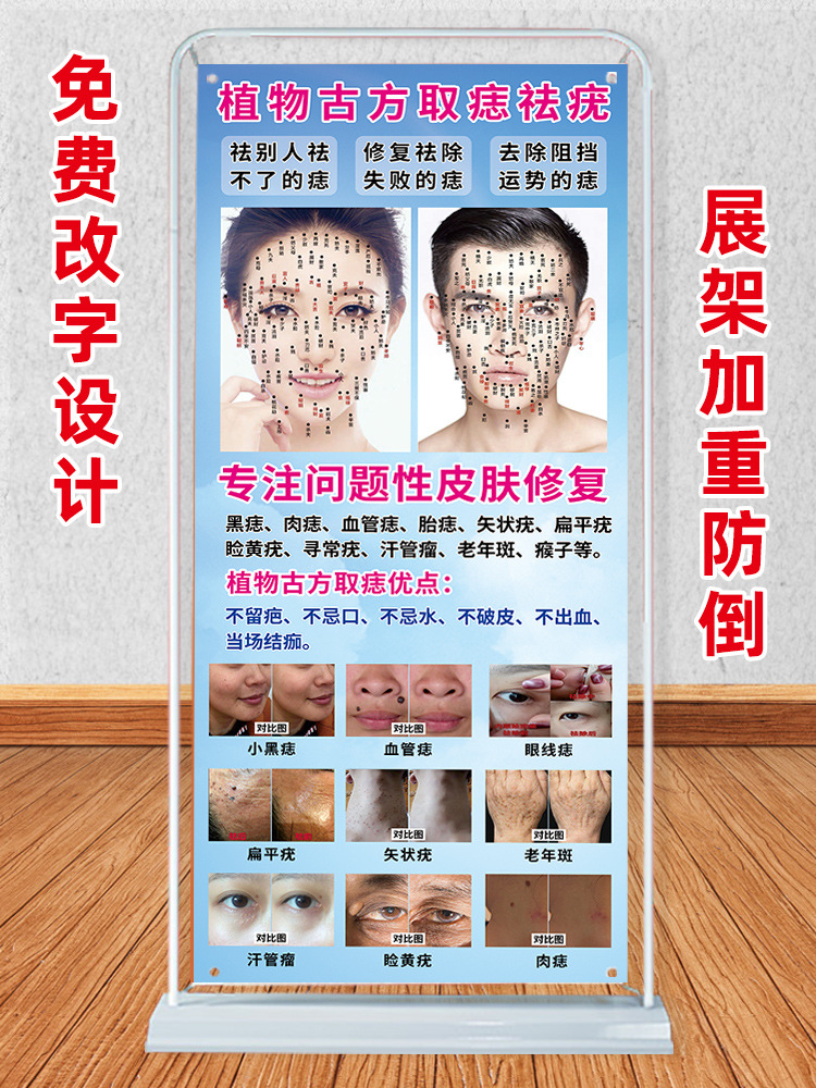 男女面痣图点痣图片面痣面相去痣海报美容院装饰画广告展架易拉宝