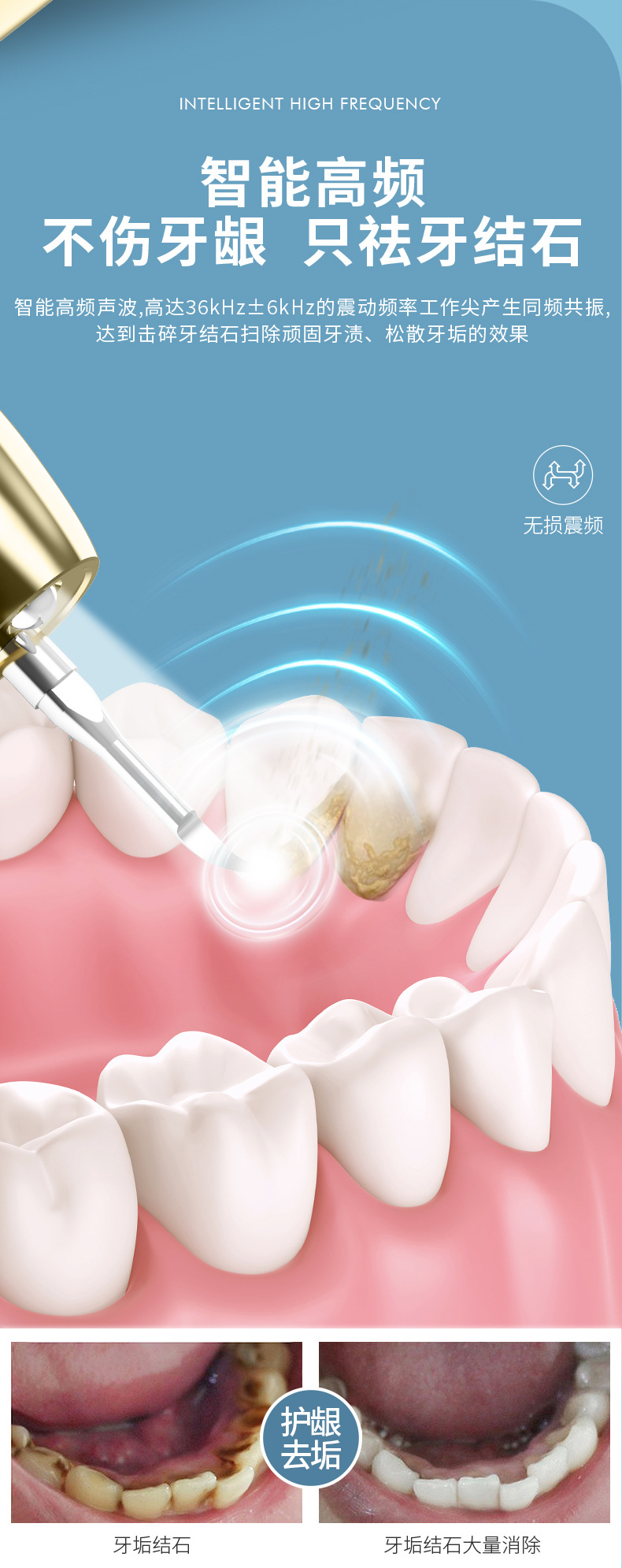 爆款推荐智能可视洁牙器超声波去牙结石洗牙器手持电动美牙仪神器