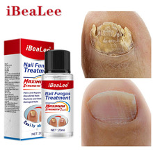 iBeaLee厂家批发灰指甲专用抑菌液脱甲膏增厚软甲灰指甲专用药水