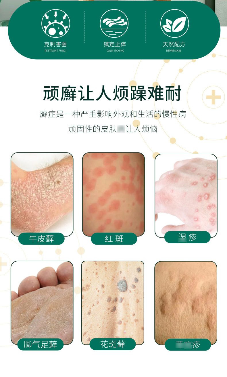 白云山癣痒皮肤护理软膏皮炎牛皮鲜藓癣荨麻 疹手脚痒脱皮药膏
