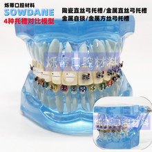 牙科正畸牙模型金属自锁陶瓷托槽金属托槽4对比透明蓝色教学沟通