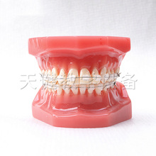 TJ-B6-03 全陶瓷28颗牙模型全陶瓷托槽口腔护理教学牙模型