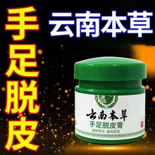 姬正云南本草手足脱皮膏20克皮肤外用止痒正品