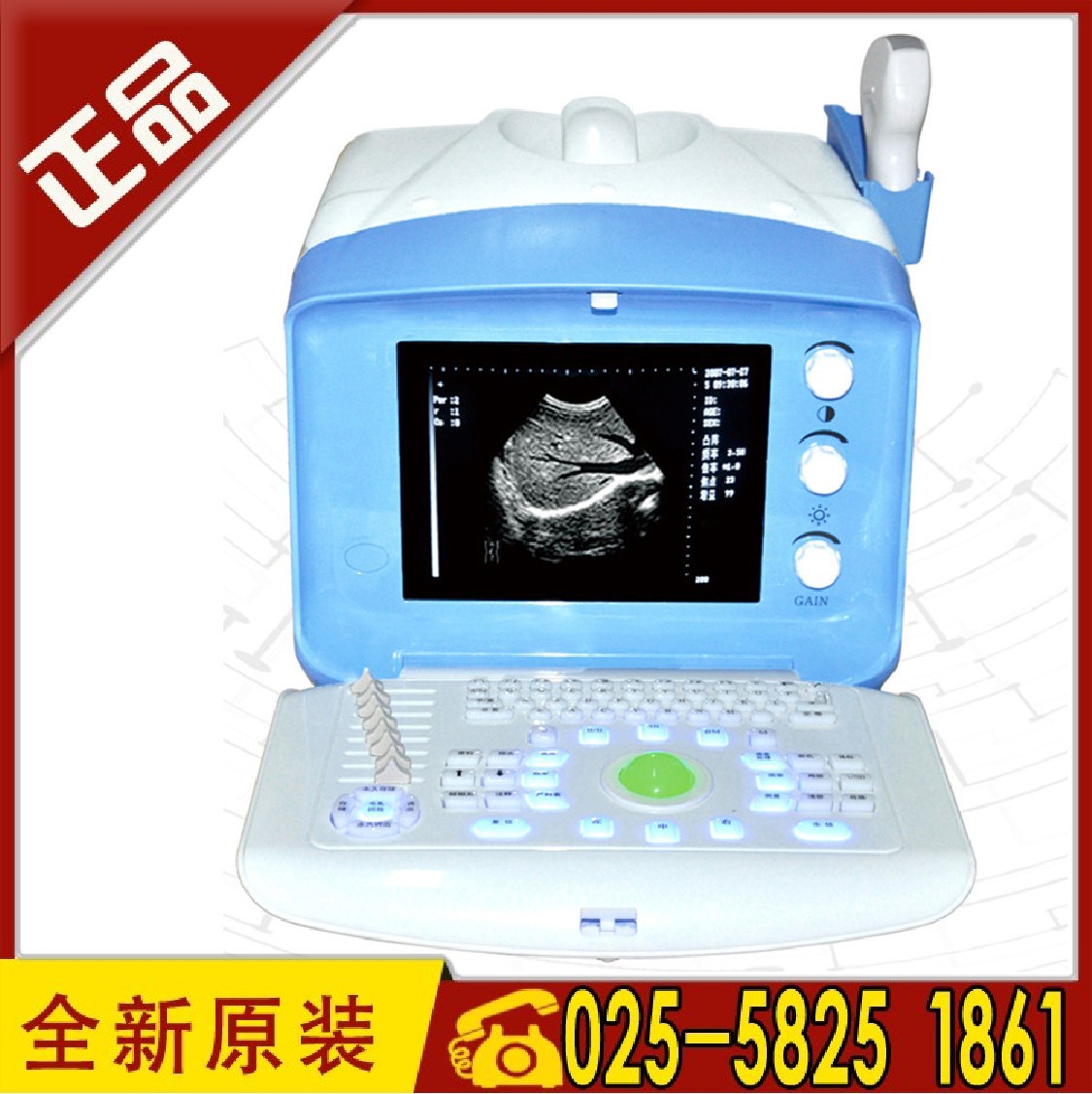 车载手提式b超机全数字超声诊断仪atnl51353b彩超机usb存储