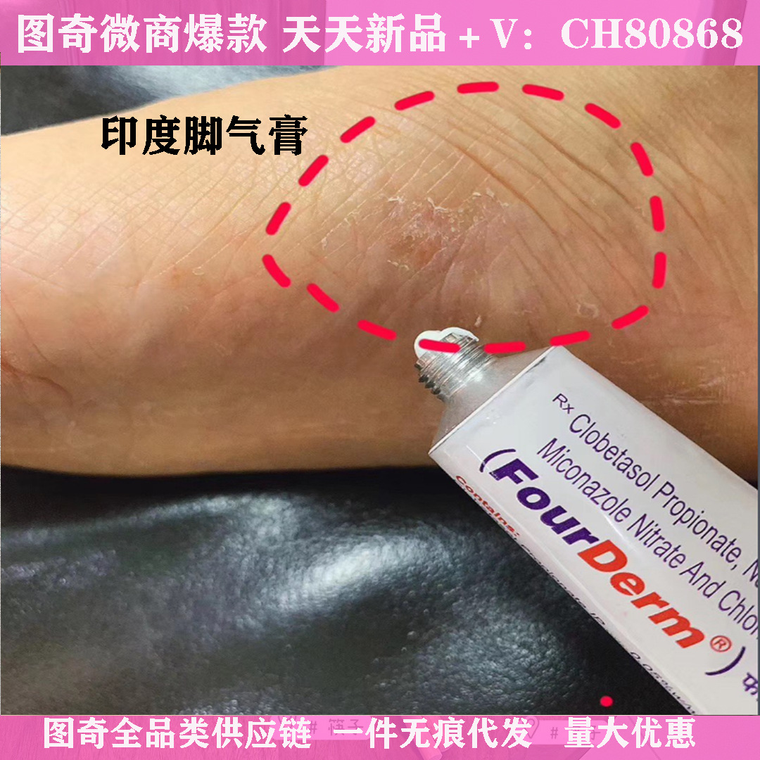 印度脚气膏20g体xian股xian脚痒脱皮起泡止痒软膏效果好