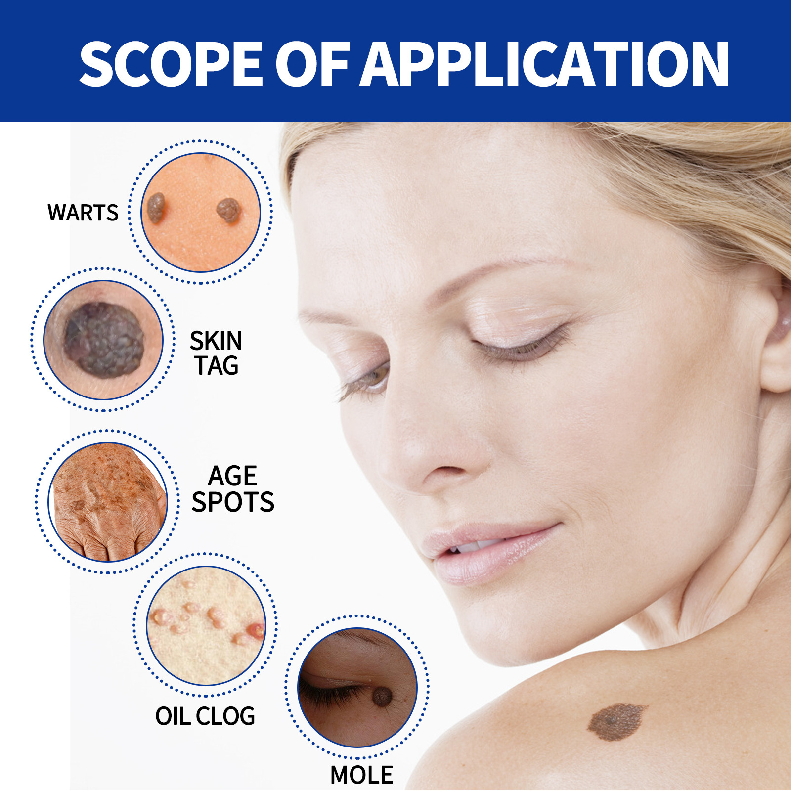 Eelhoe Wart Essence Repair Black Mole Flesh Bump Skin Burden Flat Especially Clean Skin Body Skin Care