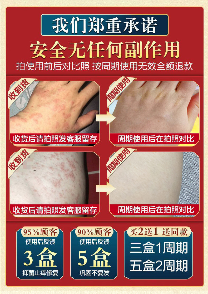 硫磺皂硫磺软膏 皮肤外用硫黄乳膏 阴囊去阴虱疥虫螨虫湿痒止痒膏