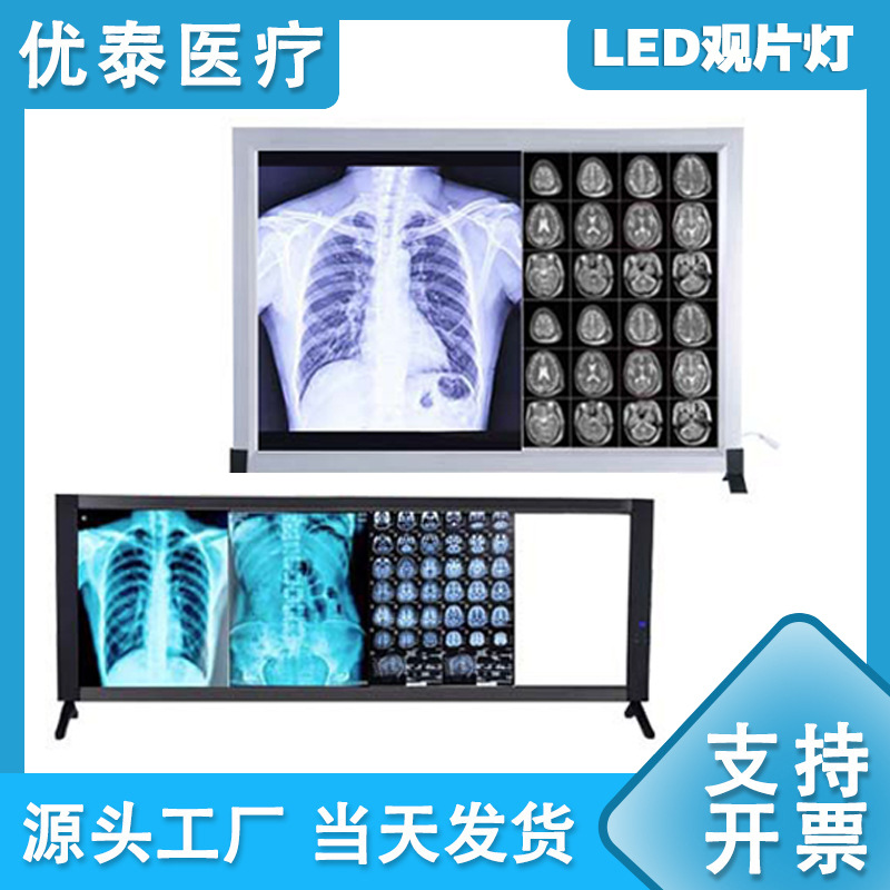 LED灯箱医学影像灯X光观片灯骨科单三联手术CT胶片阅片灯四联调光