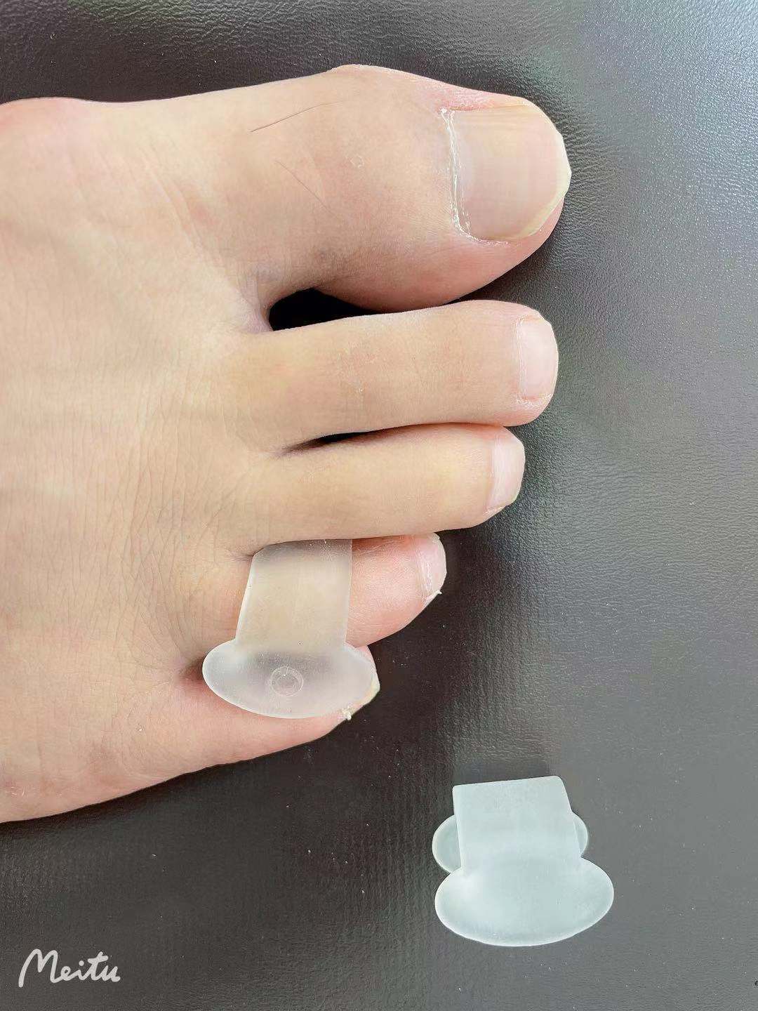 透明分趾器 脚趾分趾器
