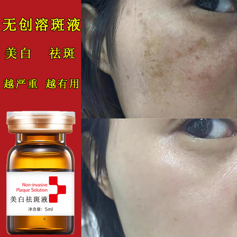 ŷȪϵ_ŷȪ߶Ǯ_ŷȪ˪