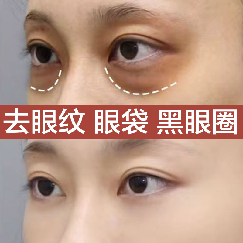 超声刀眼霜去皱紧淡纹致祛眼袋黑眼圈鱼尾纹脂肪粒眼霜小样厂批发